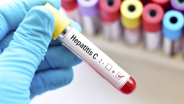 hepatitis