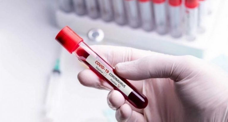 covid en sangre