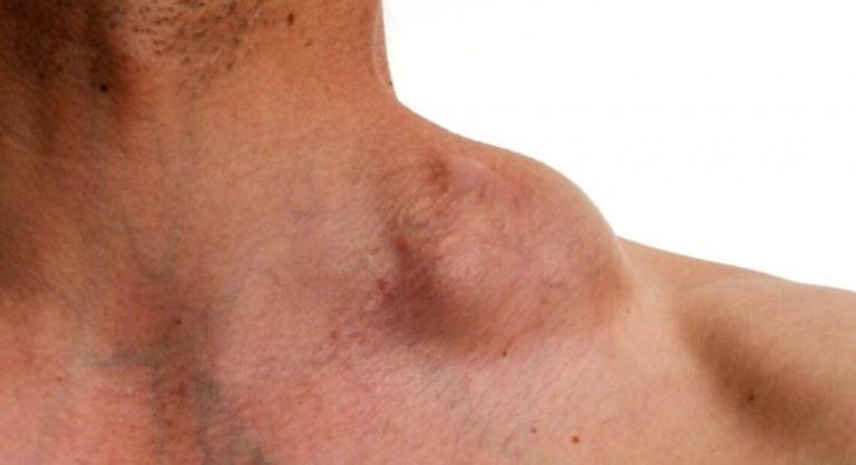 cuello